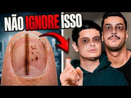 14 SINAIS do seu CORPO que parecem NORMAIS, mas NÃO SÃO