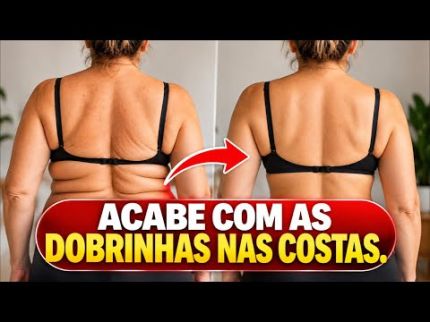 10 PASSOS PARA ACABAR COM AS DOBRINHAS NAS COSTAS |Dr Dayan Siebra