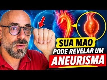 FAÇA ESSE TESTE! Sua mão pode revelar um aneurisma! | Dr Dayan Siebra